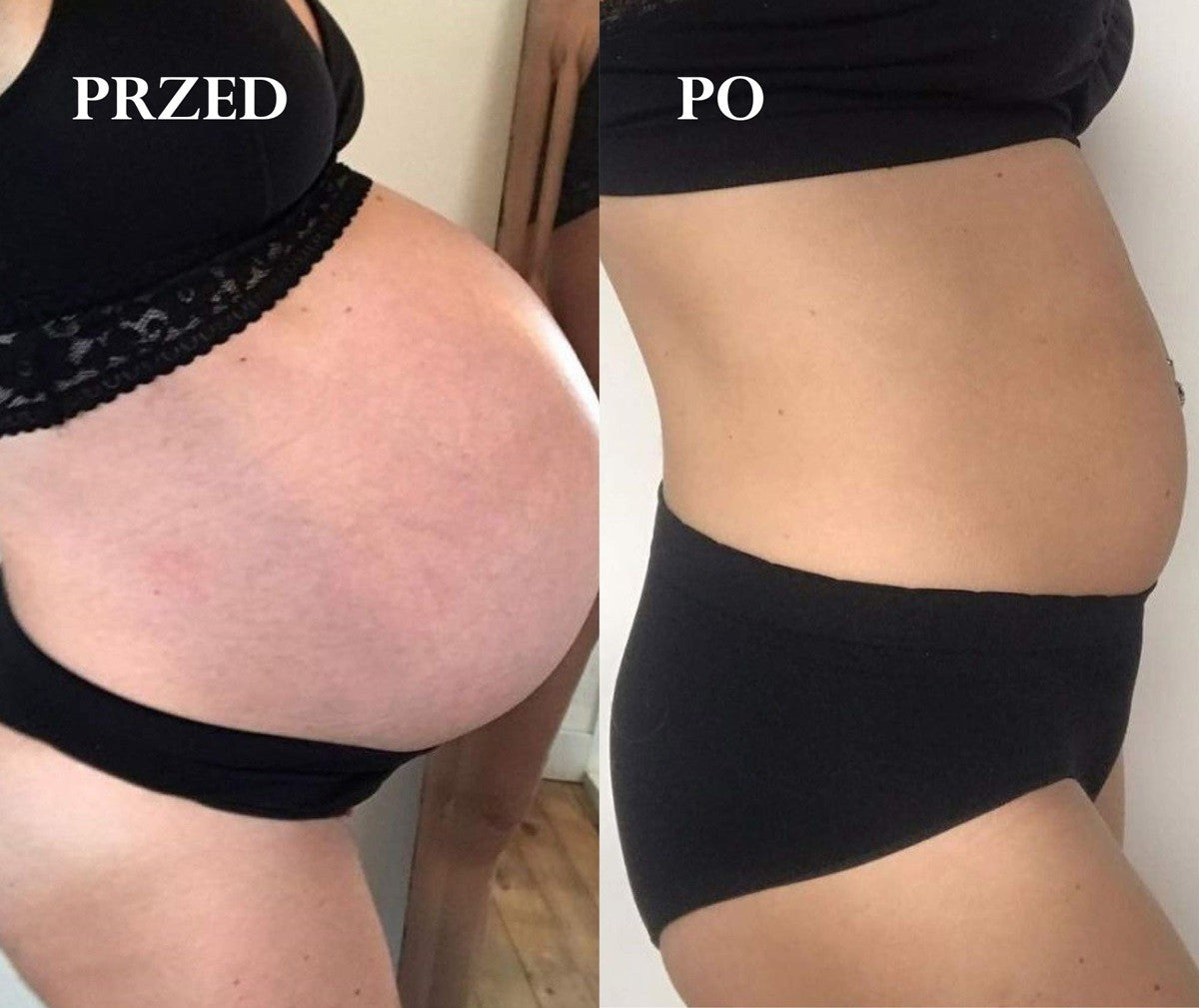 PRÓBKA: Suchy olejek do ciała zapobiegający rozstępom, dla kobiet w ciąży i karmiących, OBDAROWANA, Cosmebio, 2 ml, Omum
