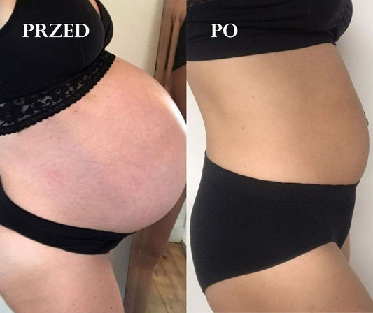 PRÓBKA: Suchy olejek do ciała zapobiegający rozstępom, dla kobiet w ciąży i karmiących, OBDAROWANA, Cosmebio, 2 ml, Omum