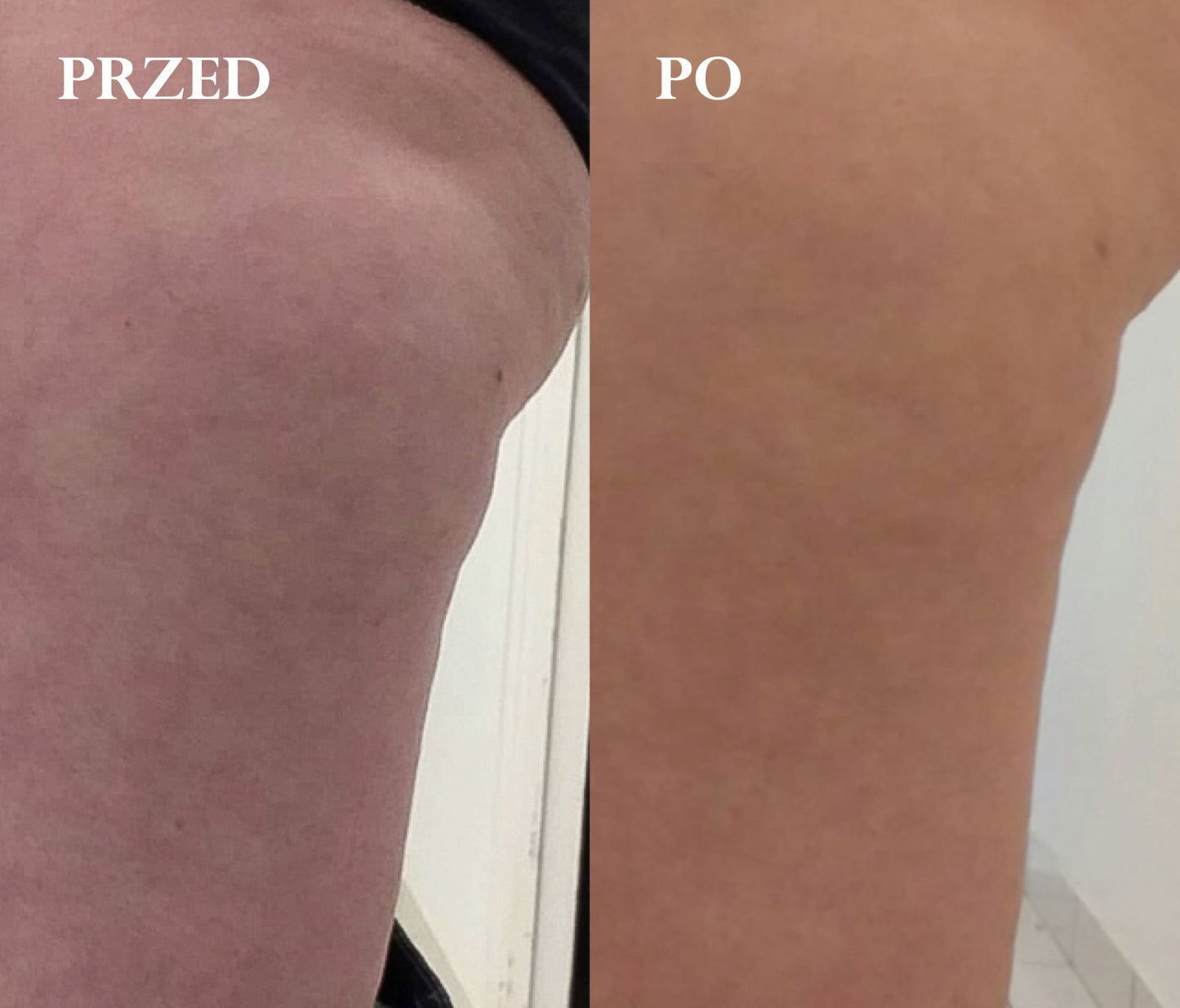 PRÓBKA: Ujędrniające i modelujące mleczko do ciała, dla kobiet w ciąży i karmiących, ZABIEG UJĘDRNIAJĄCY, Cosmebio, 2 ml, Omum